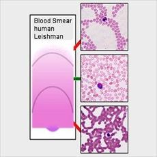 Reports, blood smear (Blood Smear)